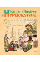 Histoire illustree de l'hyperactivite  -  le tdah et ses traitements au fil du temps